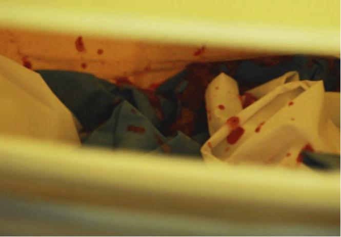 女子去黑店打胎疼死了,黑诊所人工流产手术真实事件