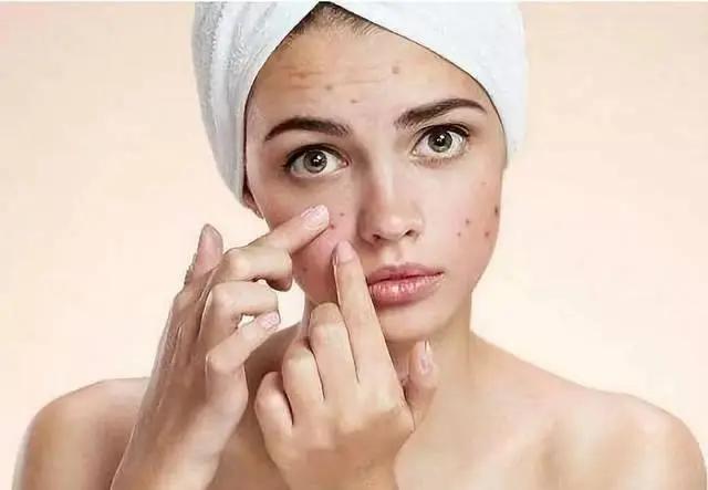 痘肌抗痘最有效的方法,痘肌急救消炎