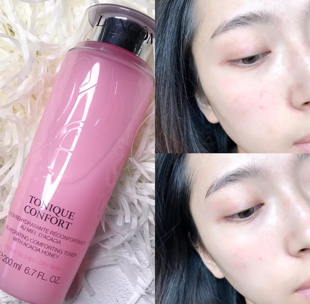 十大热门化妆水,薏仁水新款老款