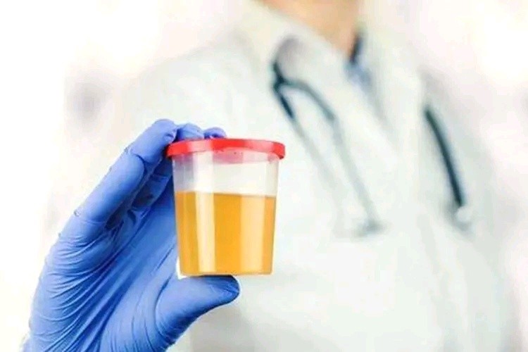 尿酸486吃非布司他20mg还是40mg,吃非布司他真的可以降尿酸吗