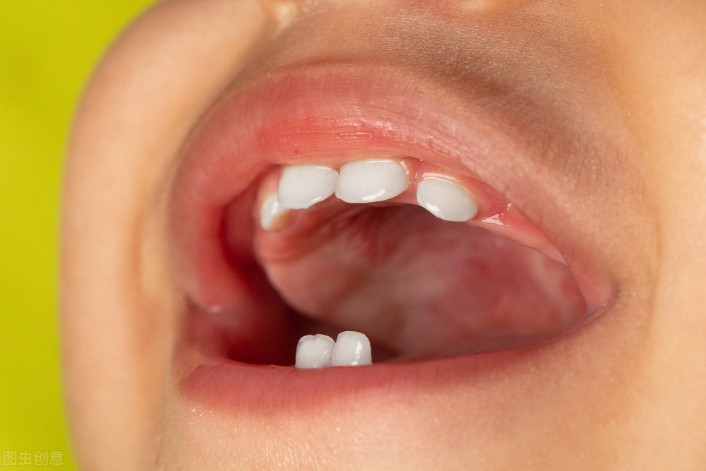 宝宝两个门牙大小不一样怎么回事,宝宝左右不分是怎么回事