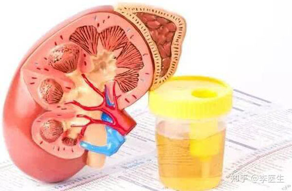 肾病患者有脚气可以用什么药,男性脚气