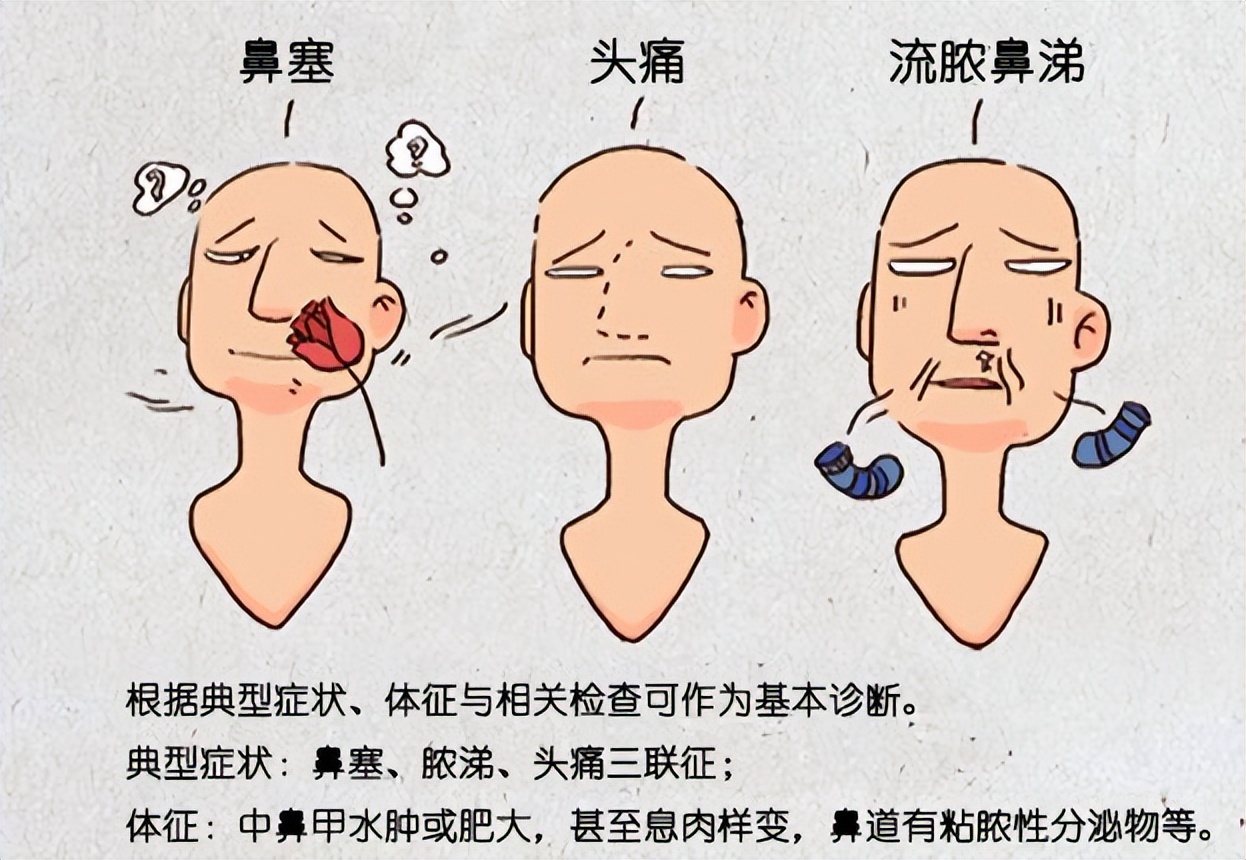 头疼鼻塞脓鼻涕是怎么回事,之前鼻塞头疼现在流鼻涕打喷嚏