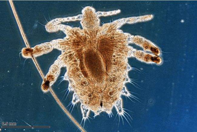 “毛”的进化！114万年前人类褪毛，*处私**腋窝毛发为何却被留下？