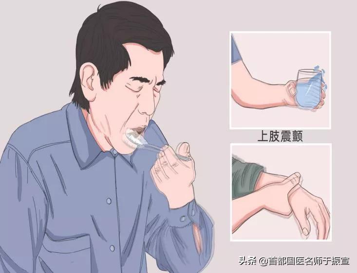 震颤中医辨证治疗,眼球震颤中医辨证