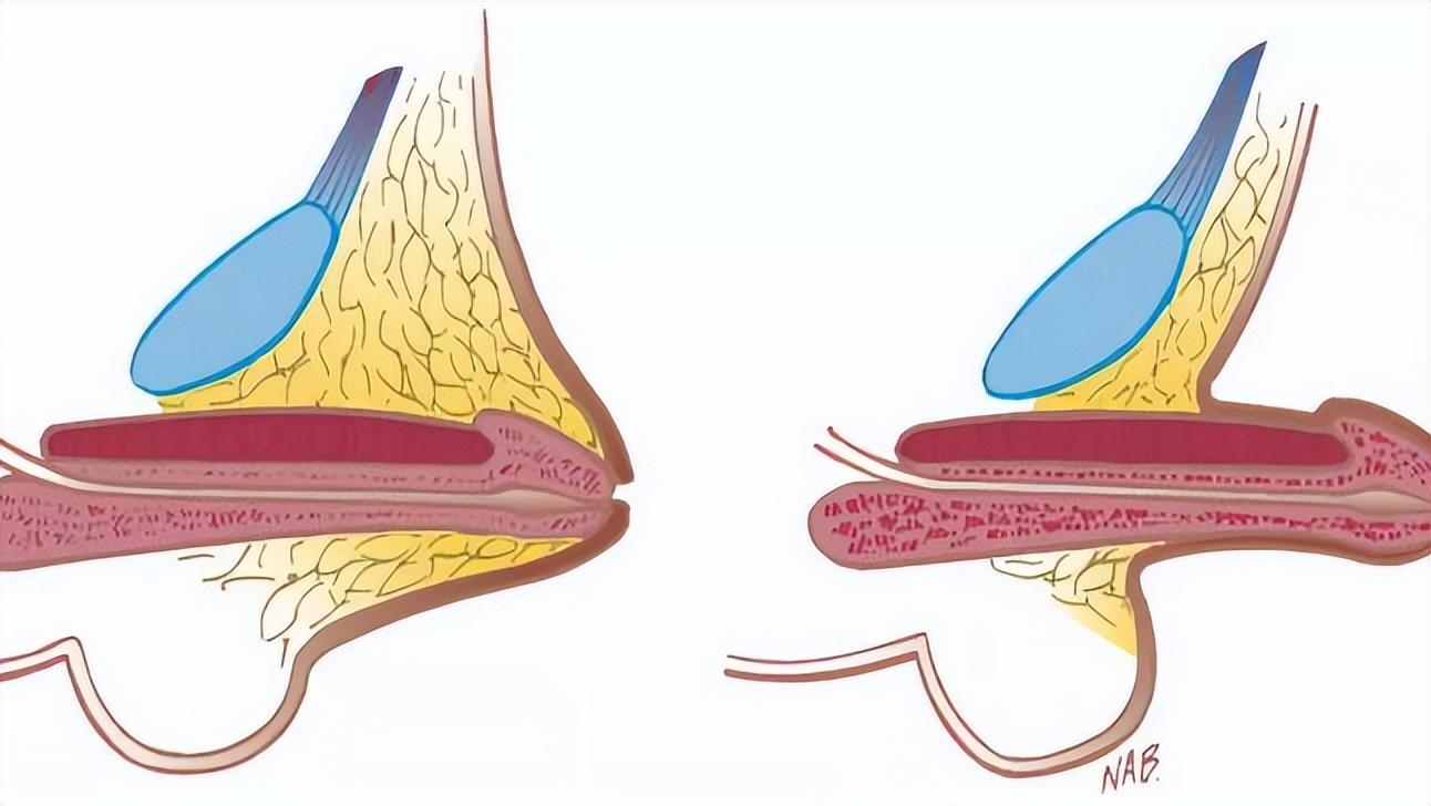 关于性知识男女必要知道的四件事,男人性健康4大误区