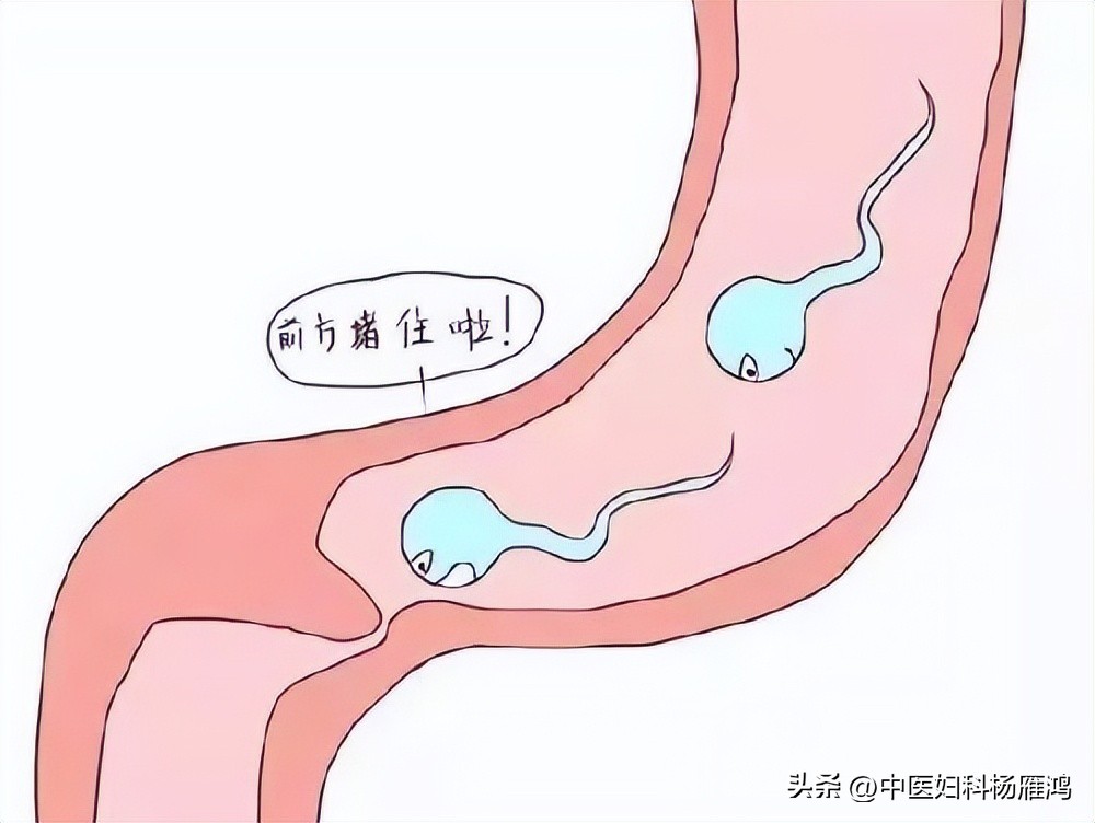 输卵管堵塞活血化瘀的药有用吗,输卵管堵塞的三大中医秘方