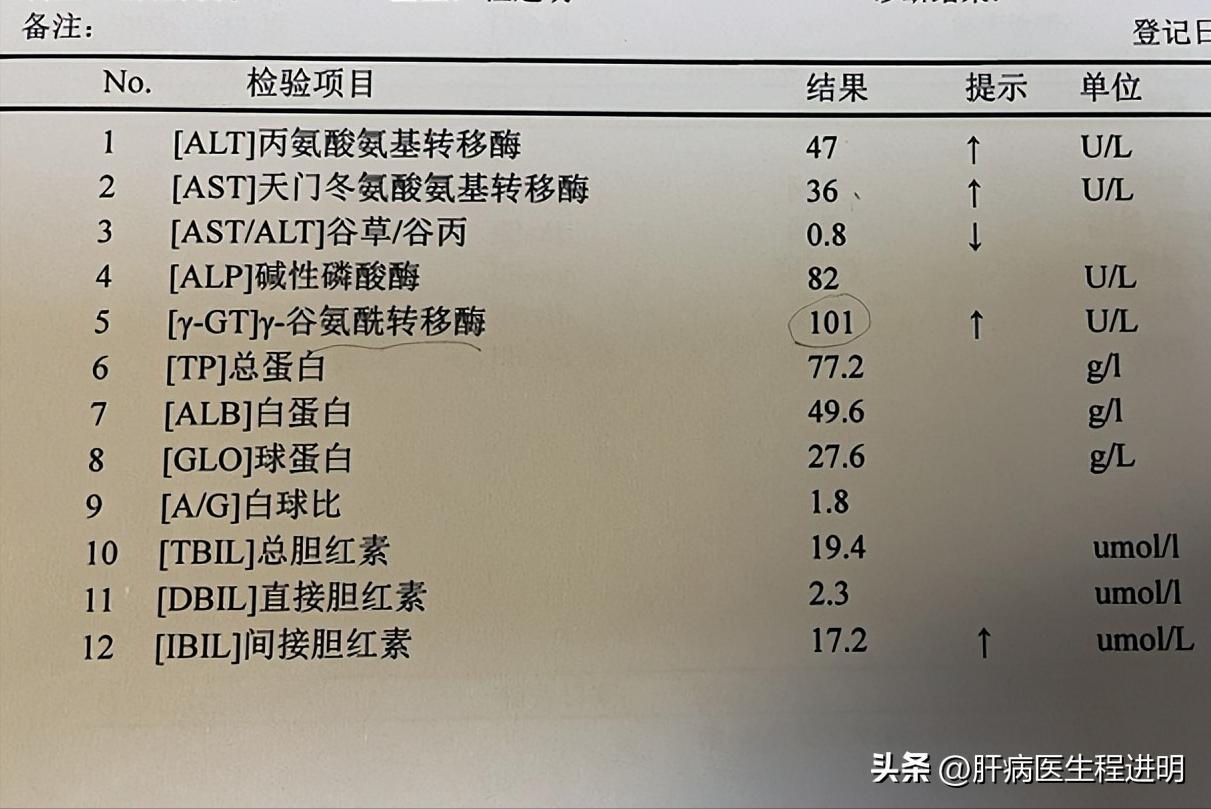 最新治乙肝方法,泥鳅粉治乙肝案例