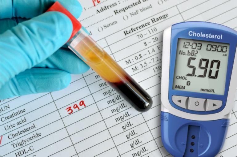 女性*处私**的润滑液是如何产生的?如何改善*处私**干燥?医生告诉你