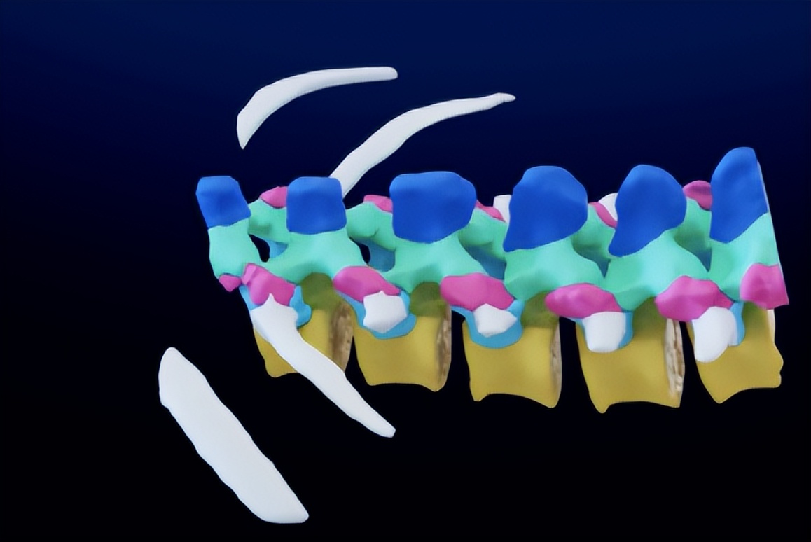 股价暴跌裁员,股价腰斩深陷裁员风波
