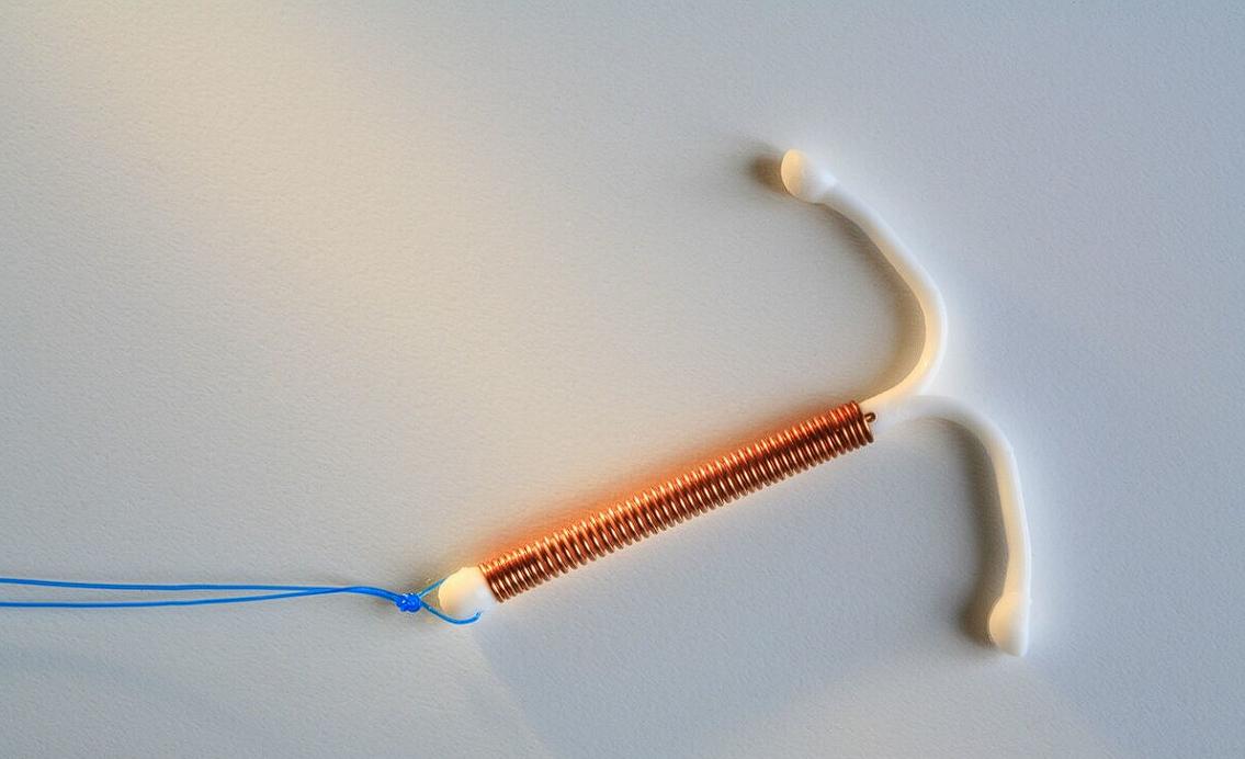 女性上环30年后的结局,以前上环的女性30多年后现状如何