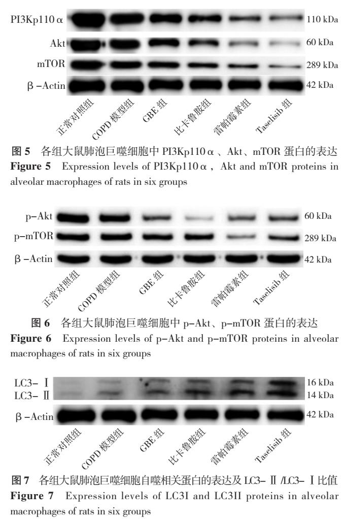 银杏叶提取物预防心脑血管病怎样,银杏叶提取物治什么病的