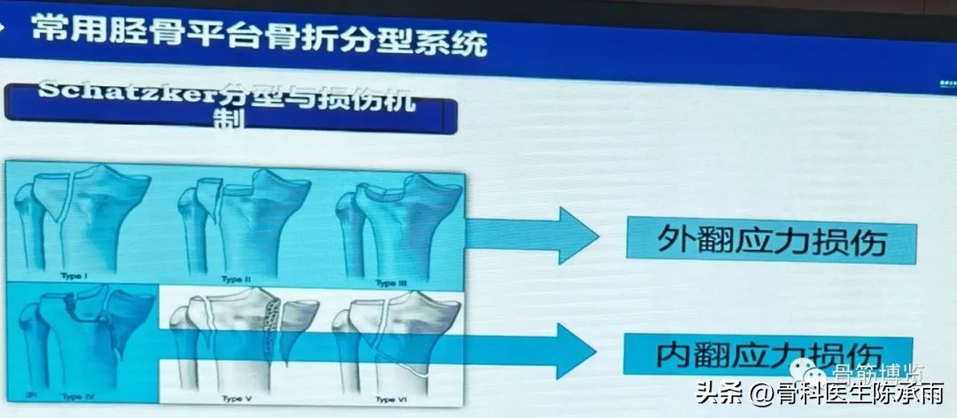 国家卫健委主办的骨创伤专项能力培训项目----下肢损伤学习班
