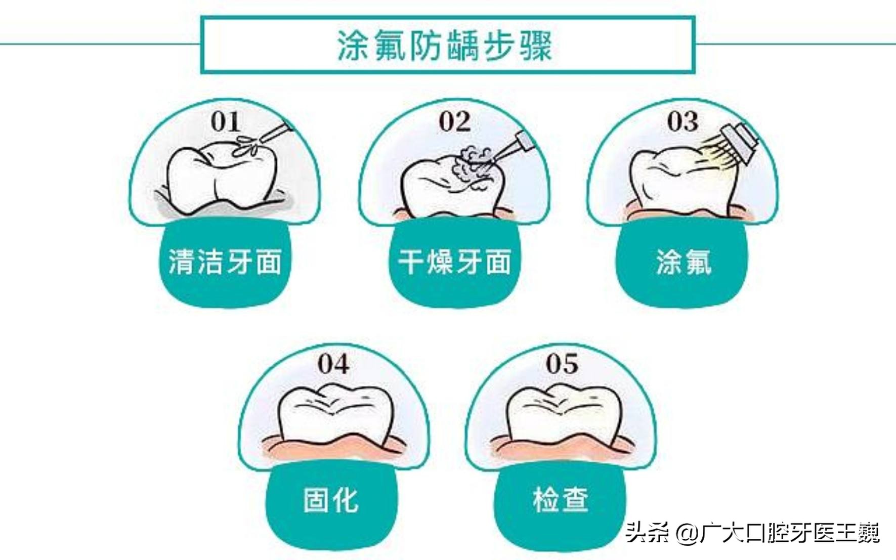 牙齿变得很白目前有几种方法,牙齿怎么才可以变白不伤牙