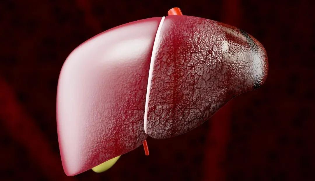 护肝最好的中成药治疗肝硬化,护肝促肝细胞再生