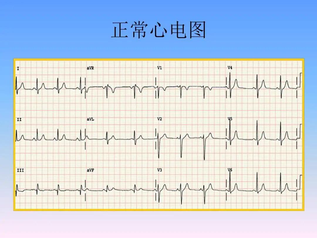做肠镜没拉干净喝水有用吗,做肠镜时感觉没排空大夫会怎么办