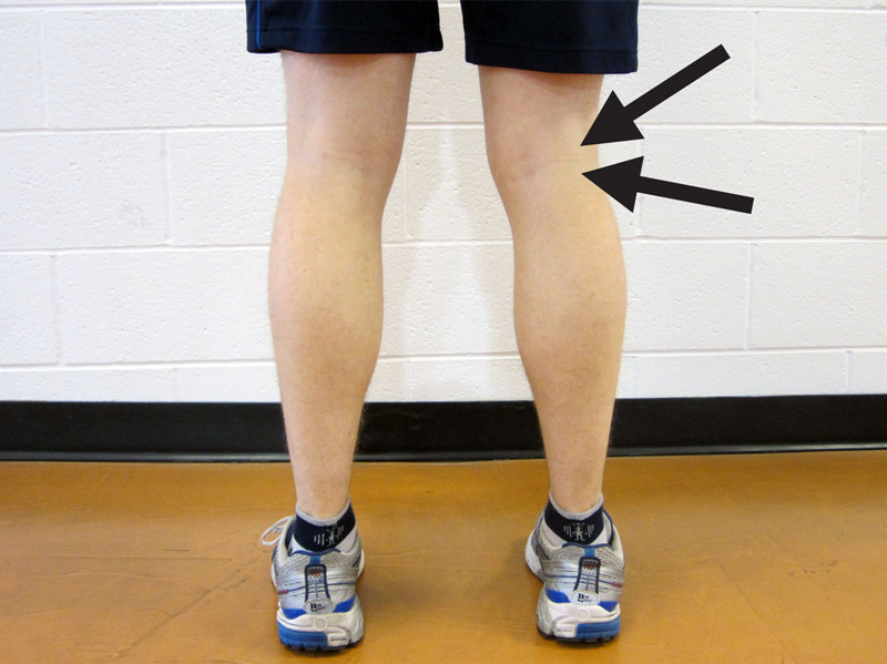 腿上有多处肿块怎么回事,腿上起肿块是怎么回事