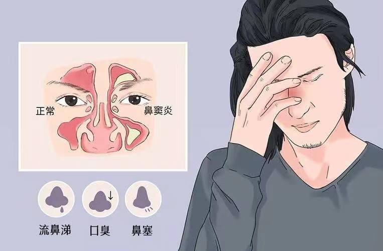 秦皇岛中医院看儿童过敏鼻炎好吗,秦皇岛有好中医治鼻炎的吗