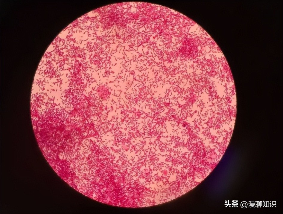 副猪嗜血杆菌是一种巴氏杆菌，其生长依赖于V因子，还有其他的吗