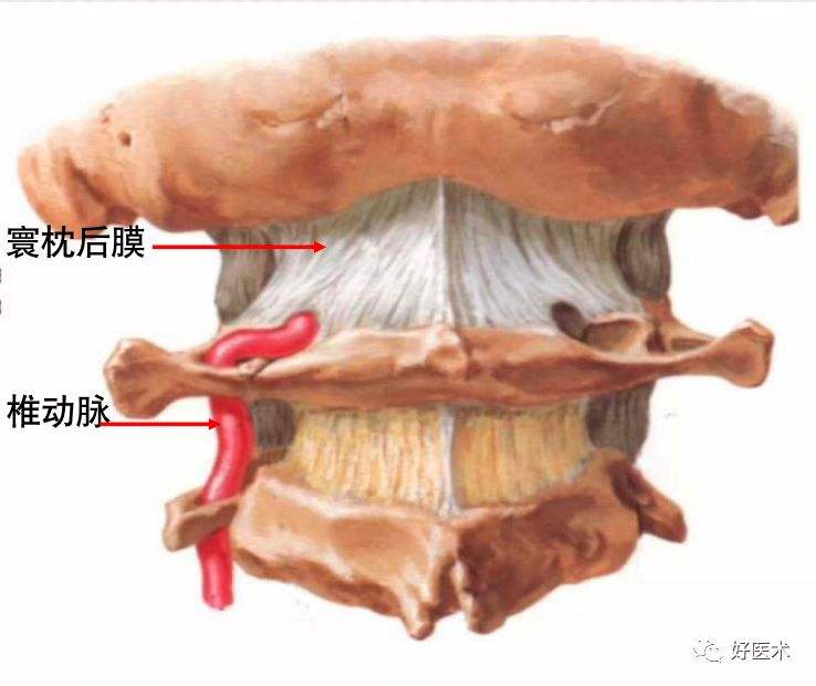 听力脑鸣伴随听力下降,脑鸣听力下降是什么原因