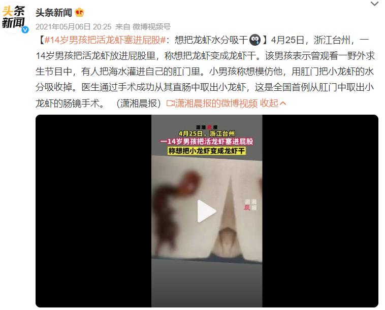 浙江14岁男孩体内取出19颗磁力珠,十一岁男孩吞磁珠