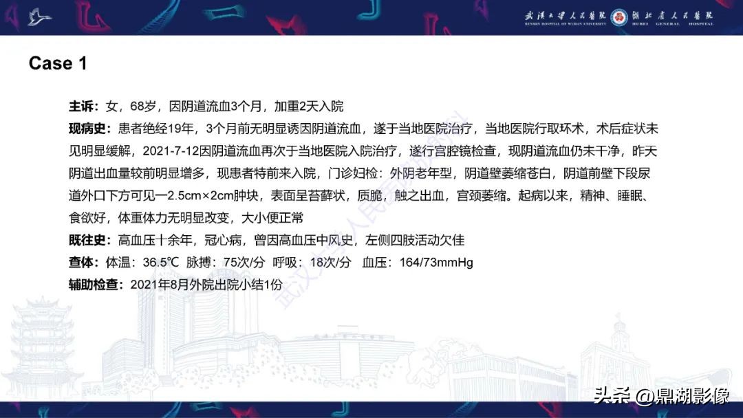 阴道里长肉瘤是啥症状,阴道肉瘤症状