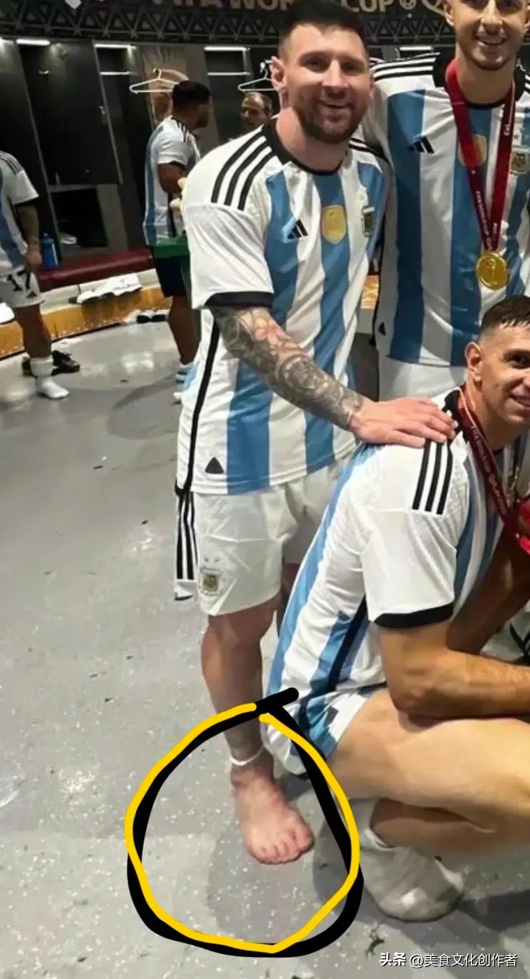 世界杯足球脚感,世界杯的冠军图