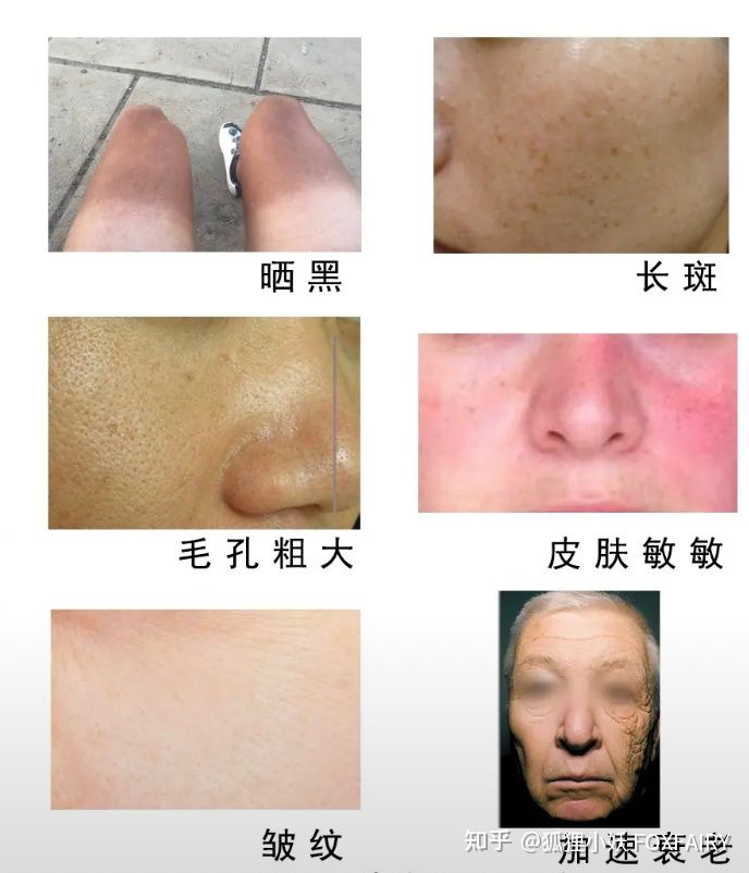 出门防晒需要注意哪些误区,教大家一种新的防晒技能晚上出门