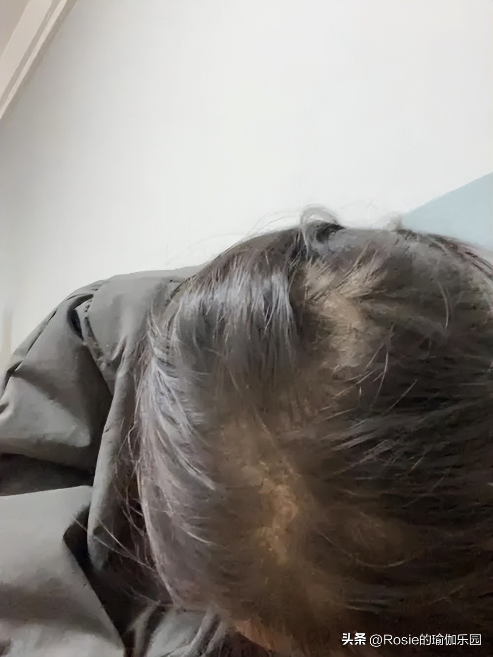 生育损伤合集,生育损伤有哪些