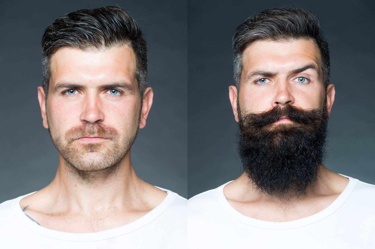 早上刮的胡子晚上就长胡茬,早上刚剃的胡子中午就长出来了