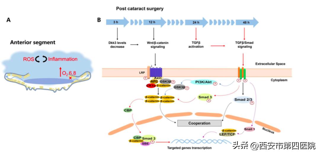 白内障药物治疗重大突破,药物治疗白内障最新研究成果