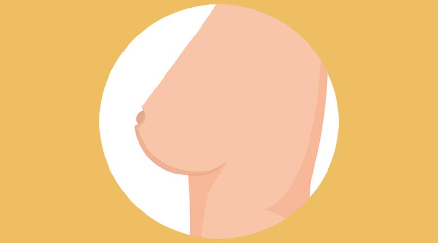 乳房出现什么症状,乳房发生这5个变化需警惕