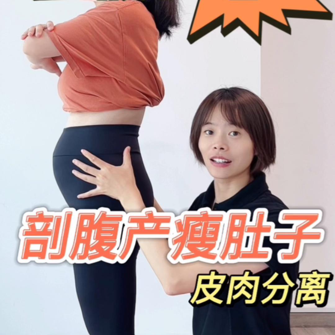 剖腹产疤痕完全恢复什么样,剖腹产疤痕40天凸起一个肉条