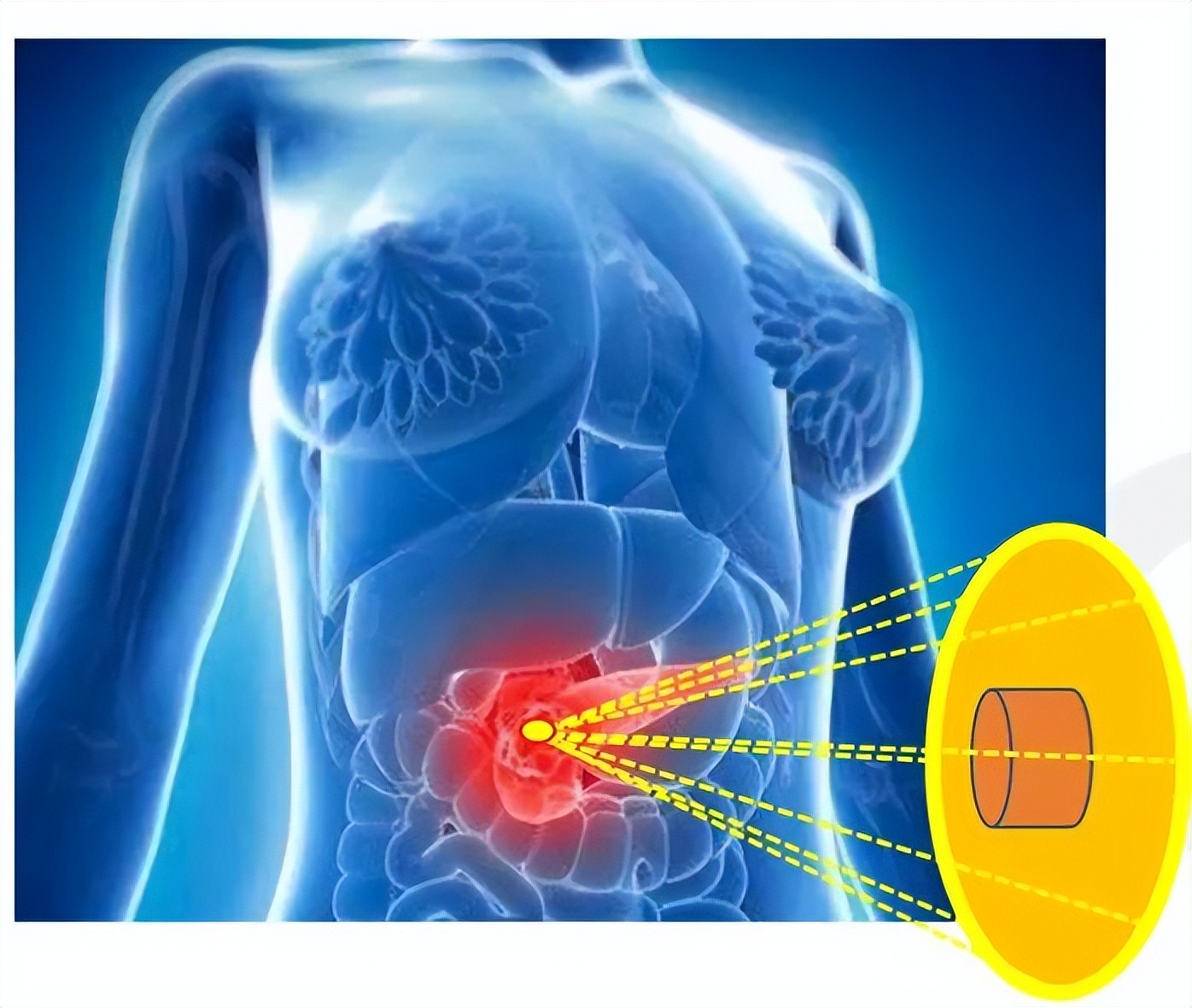 「诊疗我们更专业——技术篇」“强强联合隔山打牛”创首例