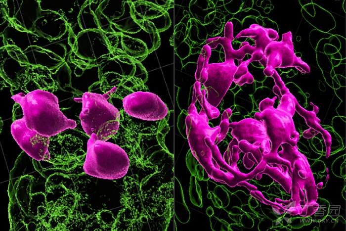 白发真能转黑发吗,头发白发转黑是真的吗