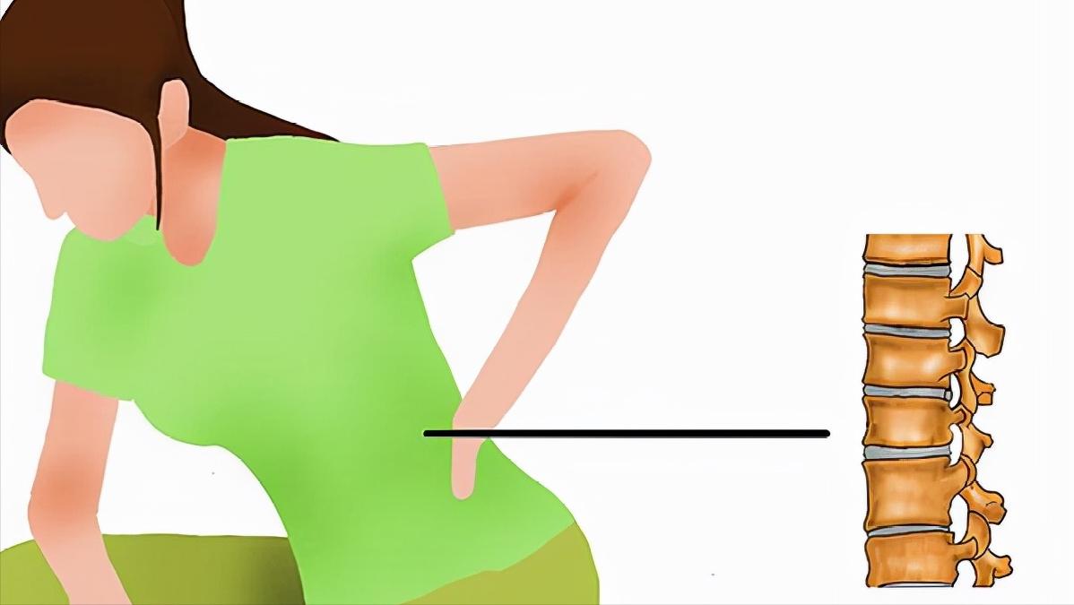 腰椎间盘突出焦虑,得了腰间盘突出需要注意什么