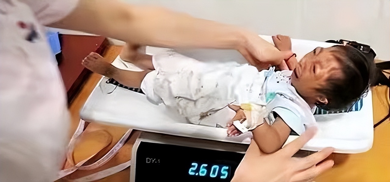 袖珍女孩梁小小出生日期,袖珍女孩梁小小现在长大的样子