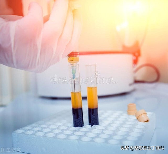 岁数小有眼袋怎么回事,年龄大的人有眼袋怎么办