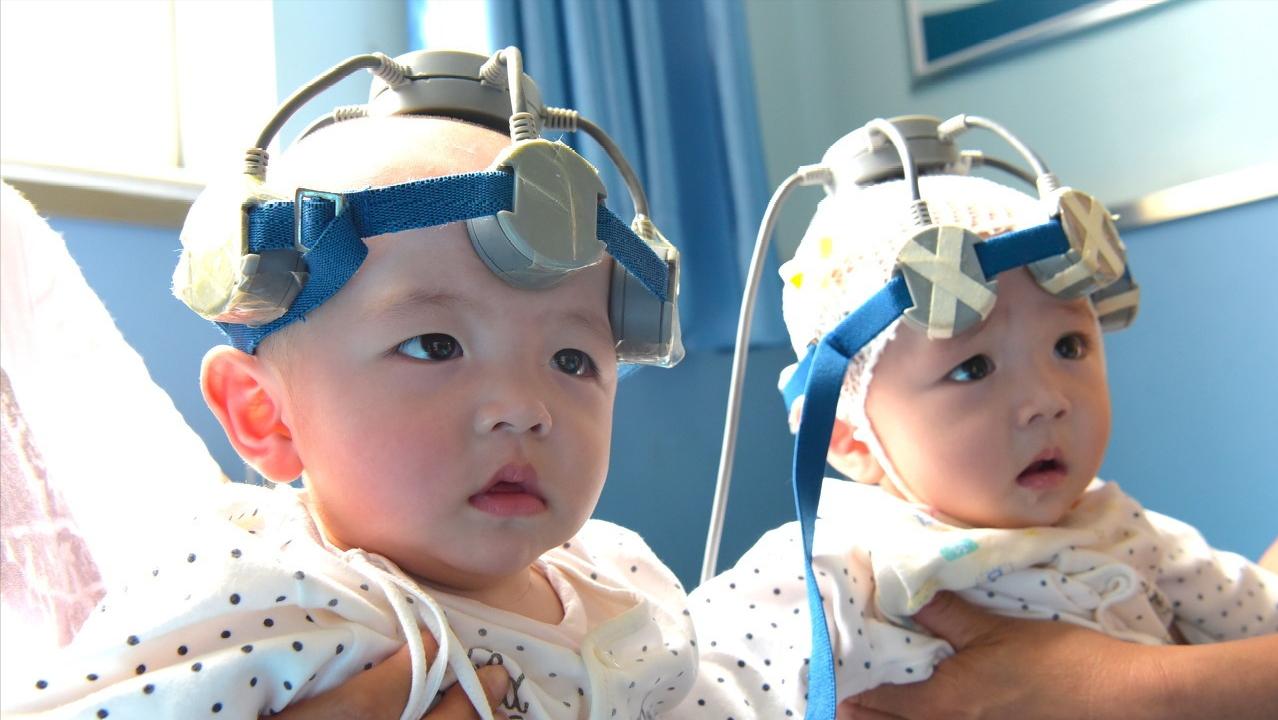 5岁语言发育迟缓终于开口说话了,多大孩子不会说话算是语言迟缓