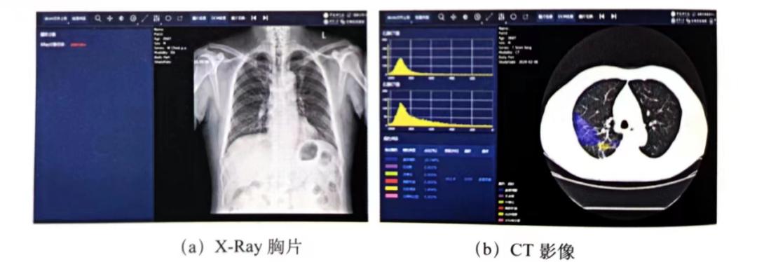 取真经|敢问IVD不卷,路在何方？（下）