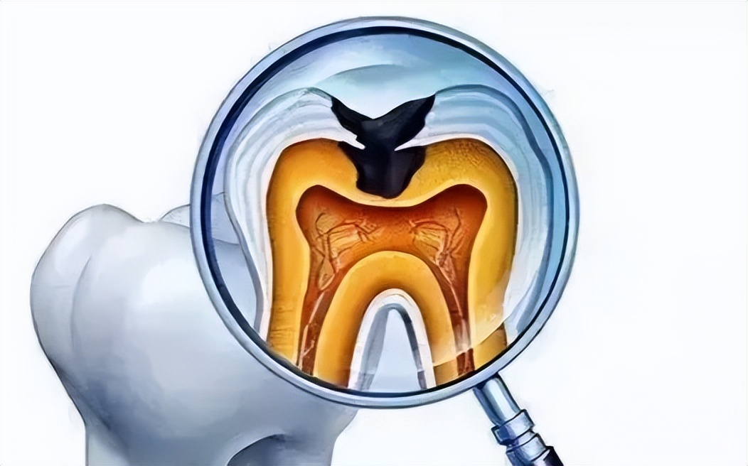 牙科恐惧症如何缓解,牙科焦虑症和牙科畏惧症