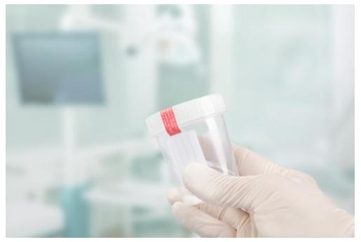 精液像“果冻”一样是怎么回事？