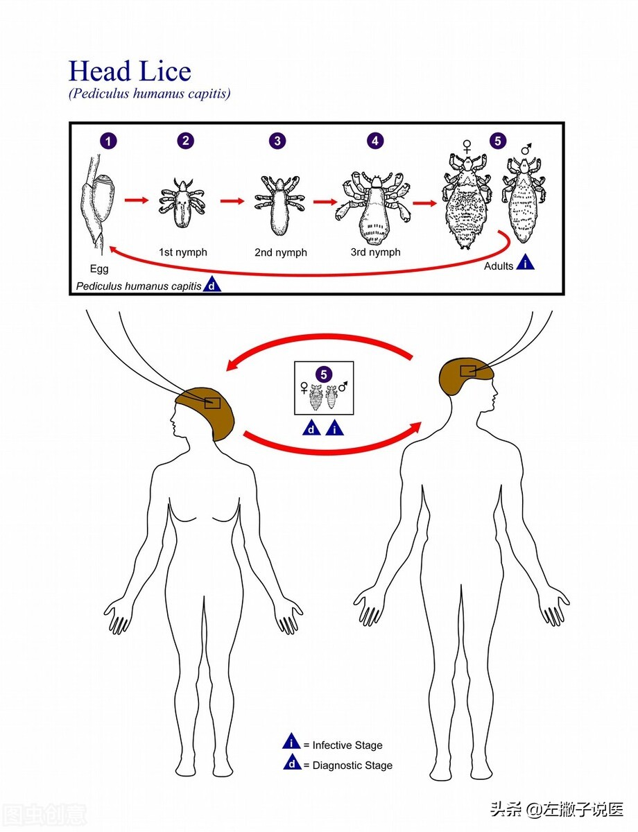 以前头上的虱子为什么现在也有呢,30年前人人身上都有的虱子