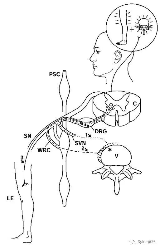 脊柱的神经支配,脊柱神经引起手臂疼痛