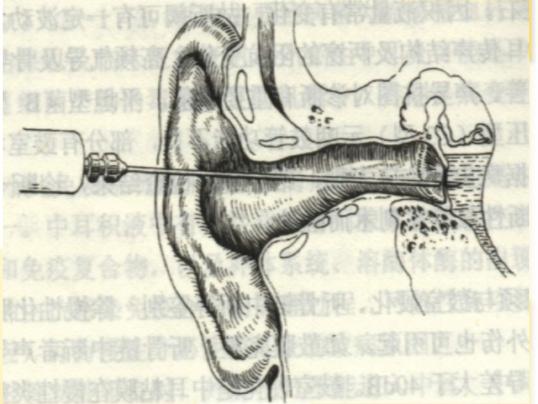 爱耳小知识,爱耳日科普