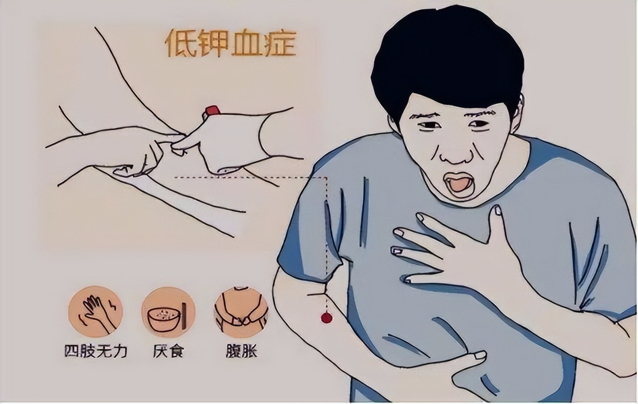 缺钾与疾病,缺钾的8个征兆如何补充钾