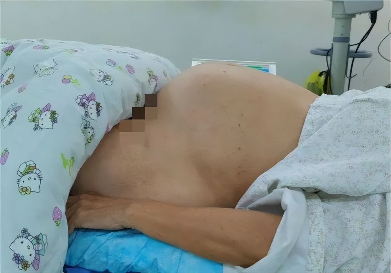 女性肚子增大是真的“肥胖”了吗，其实不然，可能是…….