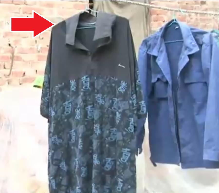 男子身患巨人症身高竟有两米四二,外国夫妇生了巨人症的孩子