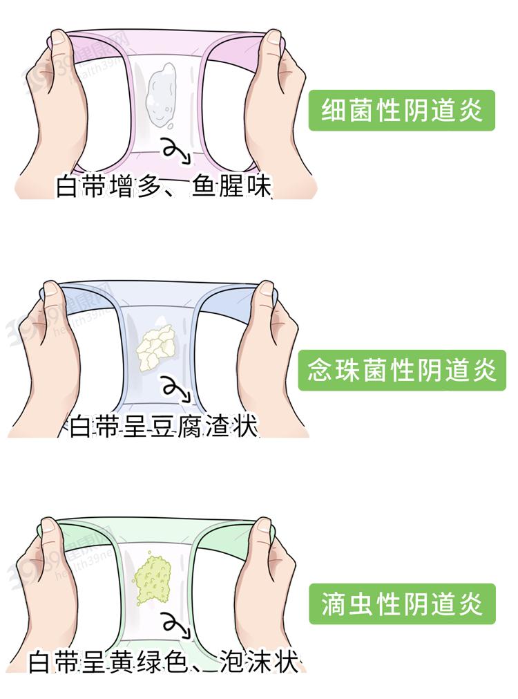 3种最不卫生的内裤,哪3种内裤不建议穿