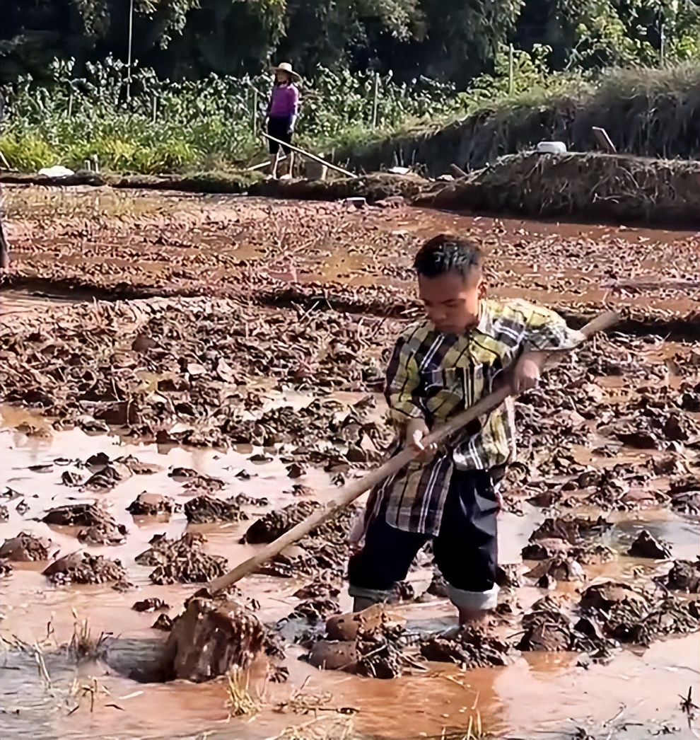 坚强的三口之家:现实版美女与野兽,肤白貌美小娇妻,嫁给袖珍男
